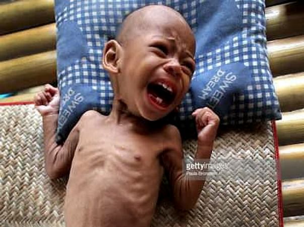 Help poor children to fight malnutrition