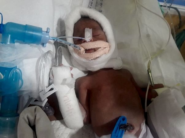 Help Mona and her Premature Infant