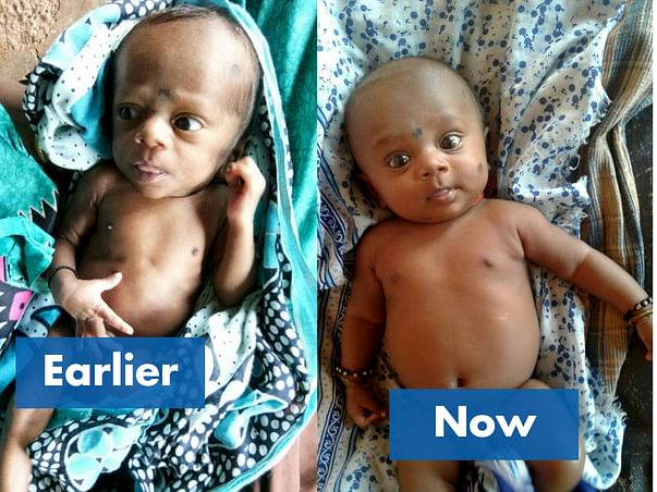 Save lives of 100 malnourished children in Palghar, Maharashtra.