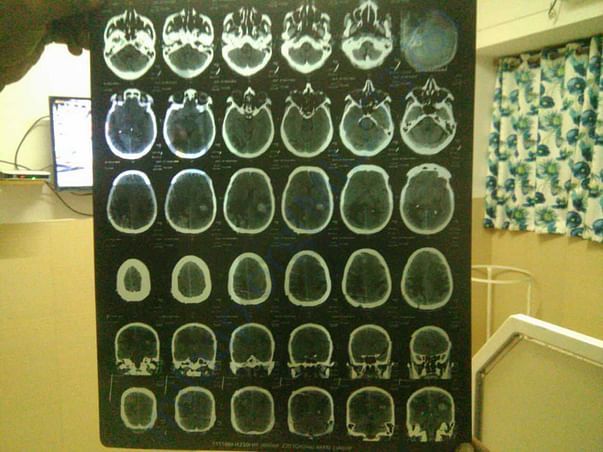 Brain X-ray