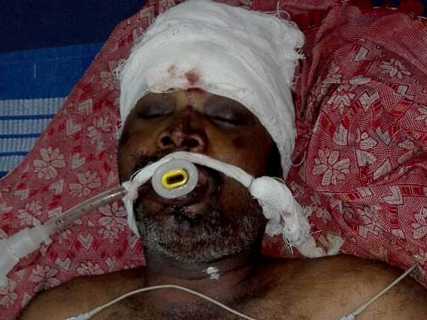 Help Sankar Recover From Road Accident