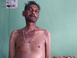 Help Him To Fight Against Liver Disease