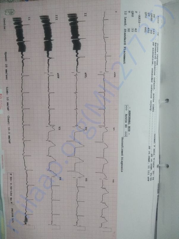 Electrocardiogram Report