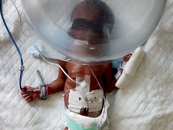 HELP MY NEW BORN PRE MATURE BABY WHO IS IN NICU
