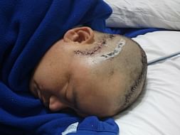 Help Dharma Lepcha Fight For His Life