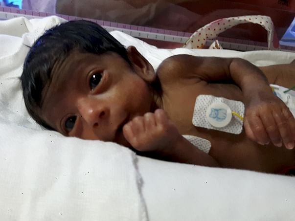 Help Banumathy's Preterm Baby Born At 30 Weeks