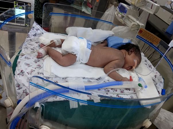 Help Baby of Kiran Kumar