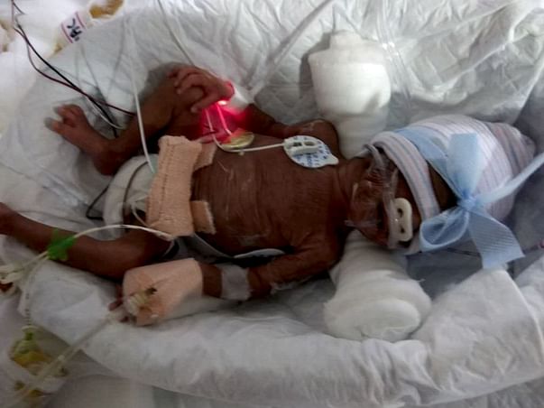 Help PrematureTwins who are now in the ICU fighting for their lives