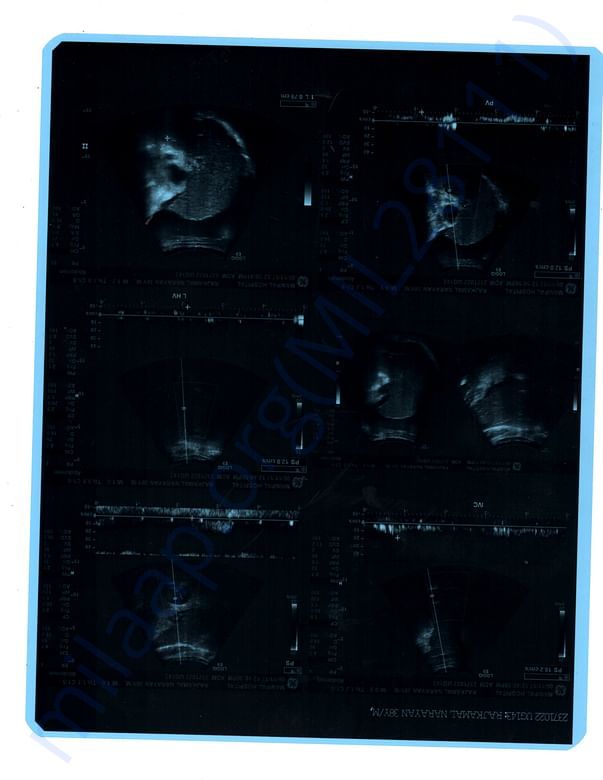 Ultra Sound Image 1