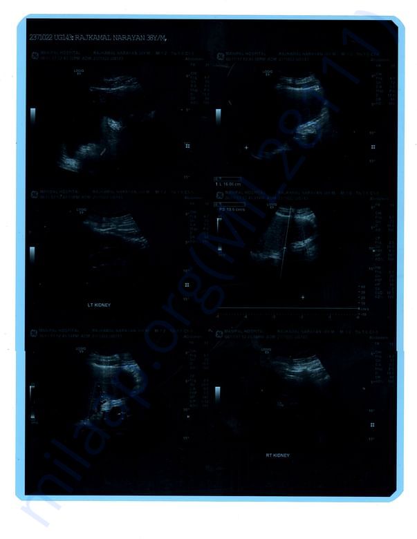 Ultra Sound Image 2
