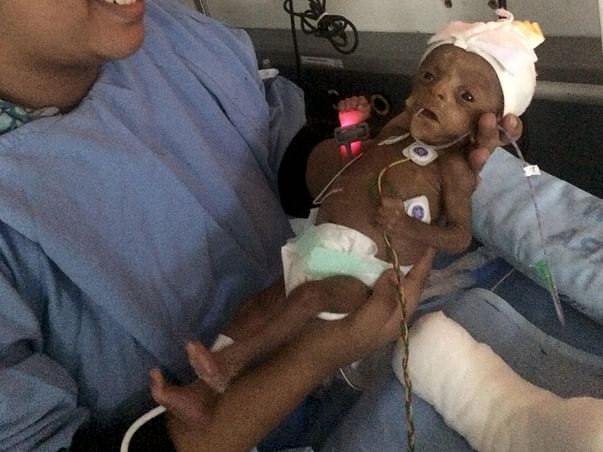 Help My Premature Baby