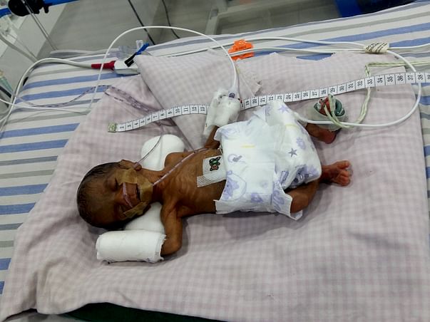 Father of a Premature Baby Sold All He Had To Try And Save His Baby