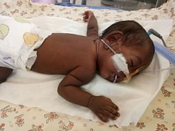 Sudha's baby is two months premature and she is struggling to save him