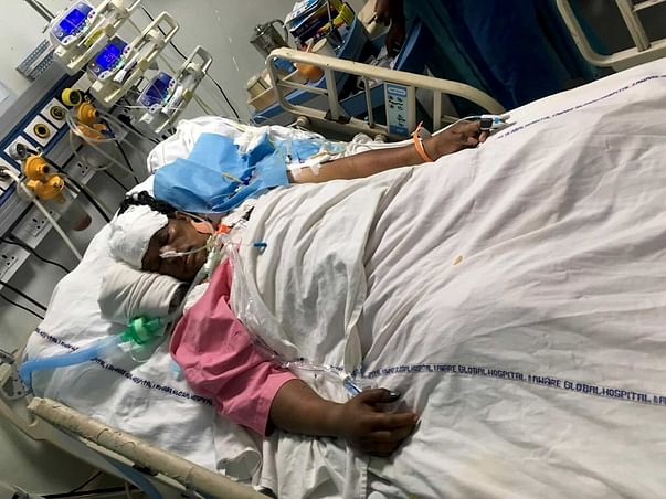 Save A Friend's Mother From Viral Pneumonia Infection (ARDS)