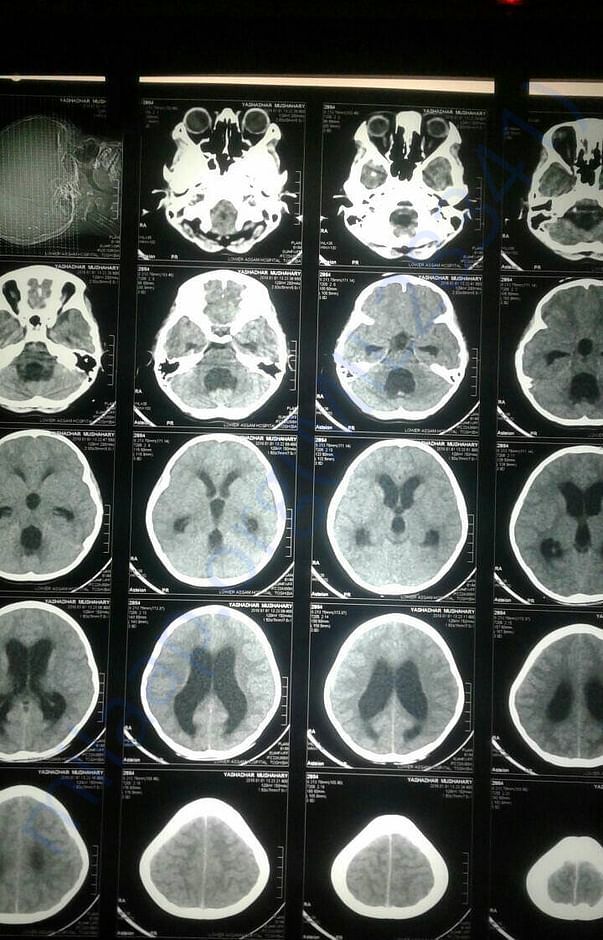 CT scan copy