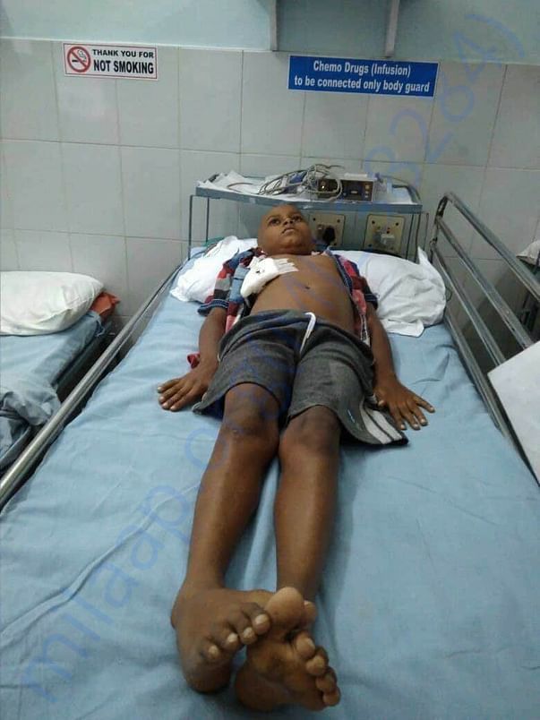 Madhan treatment photo
