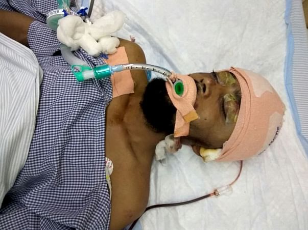 Help Rashmi Ranjan Nayak Recover From His Accident