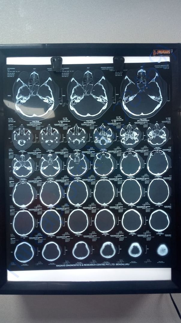 First CT-Scan