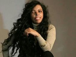An Event to Create Platform For Acid Attack Women