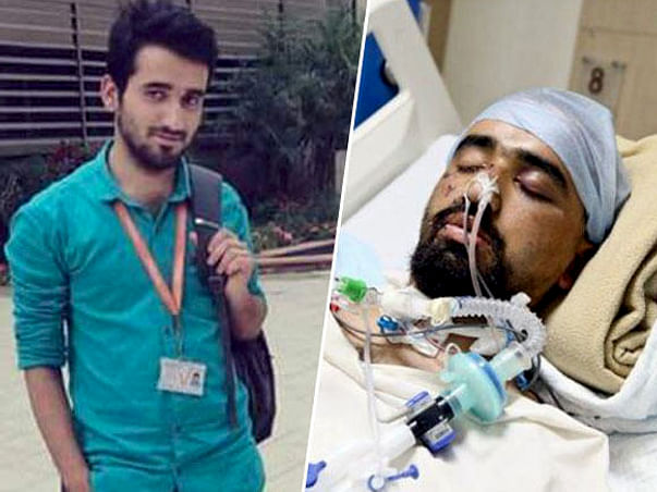 Beigh Is Fighting For His Life In The ICU After A Tragic Fall