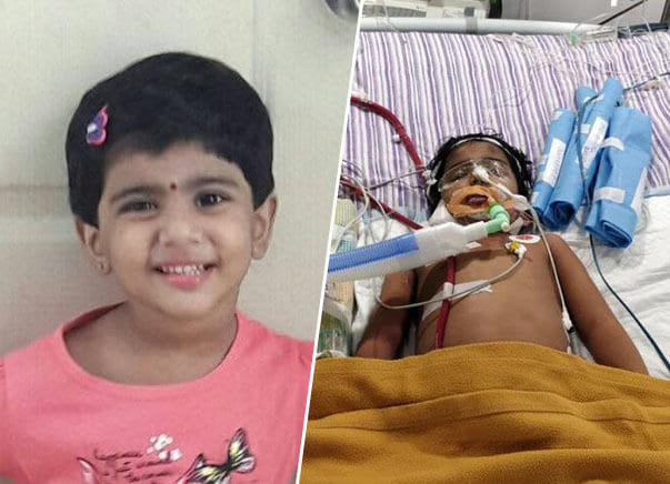 You Can Save 3 Year Old Sandhiya Who Is On Artificial Lung Machine Milaap