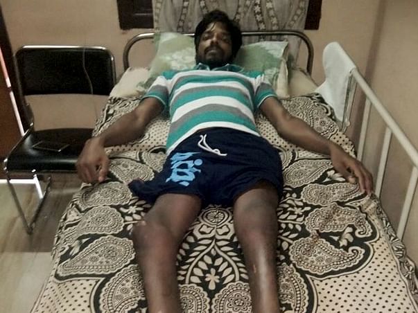 Help Manjunath - Bed ridden from Past 13yrs to Walk