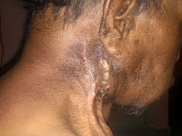 Save my Dad from cancer
