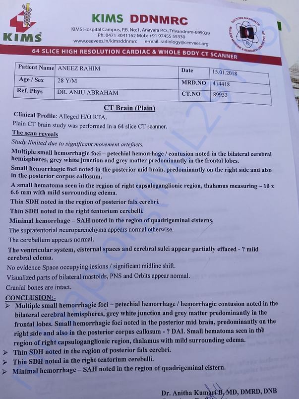 CT scan report of Brain