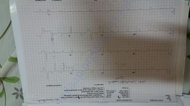 ECG report
