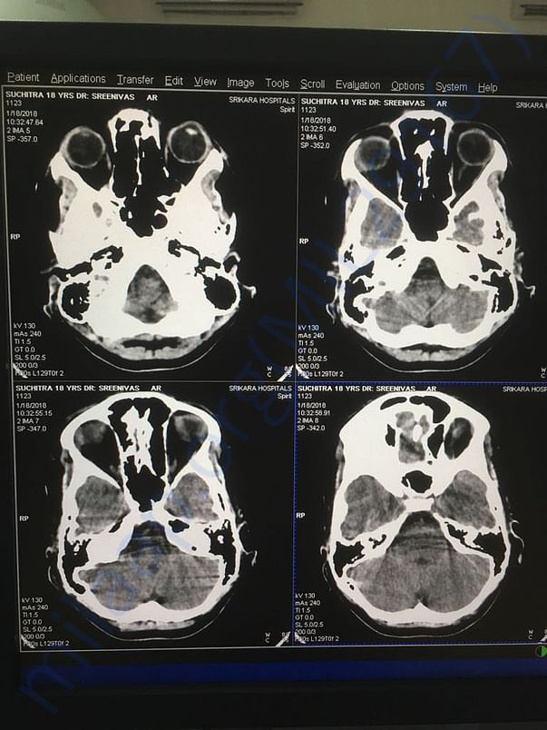 Scan images