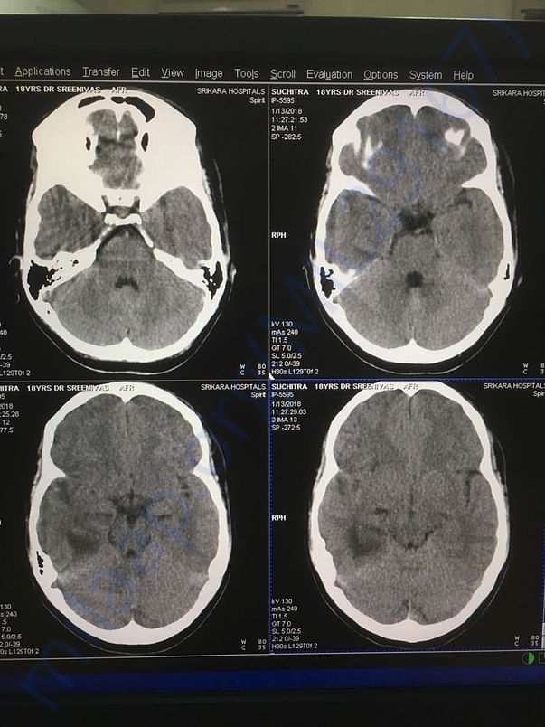 Scan images