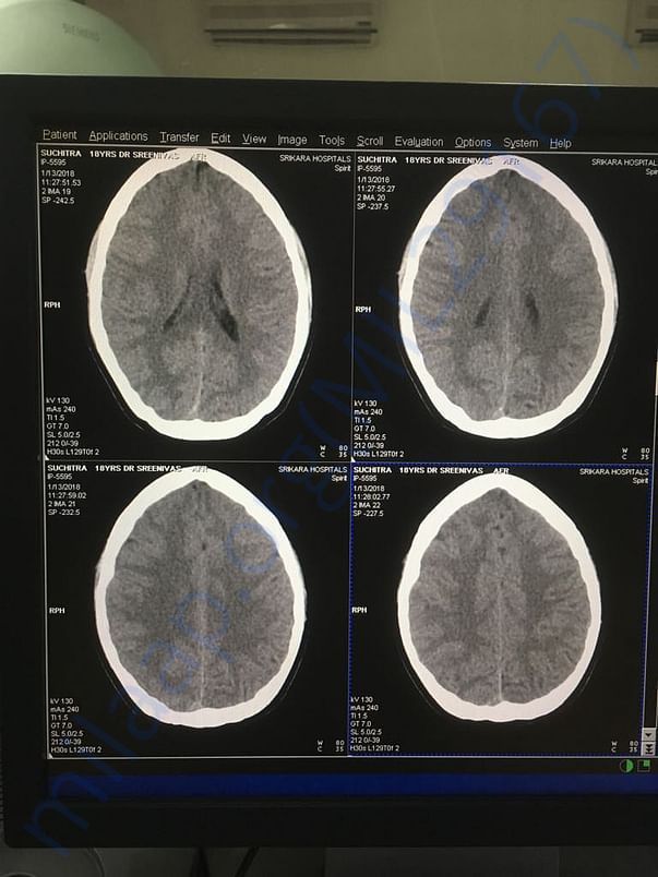 Scan images