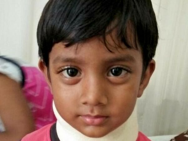 Help 3-yr old Srinu fight Cancer