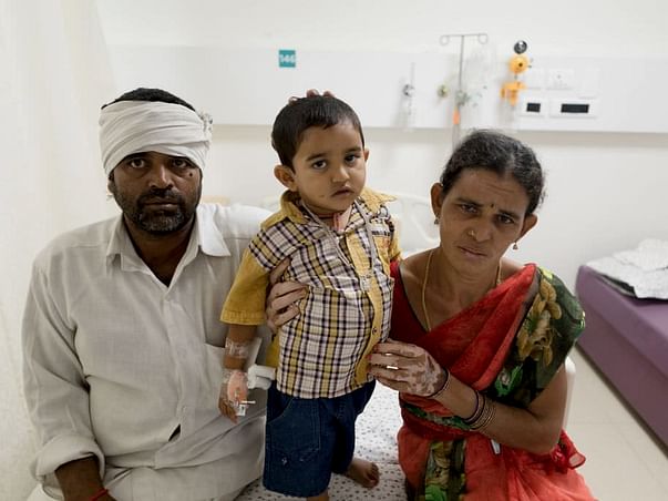 From the time he was 18 months old Mohan struggles with Liver disease