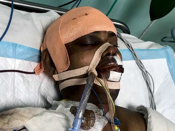 Bobby is looking to support his brain surgery bills