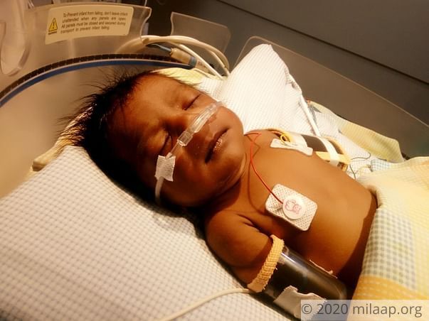 This 1-month-old's Heart Will Stop Beating Without An Urgent Surgery