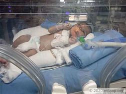 Help Baby Of Nazmeen Khan Who Is Under ICU