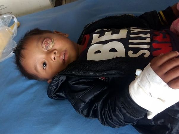 Baby Keffrien's Eye Has Been Ravaged By Cancer, Save His Life