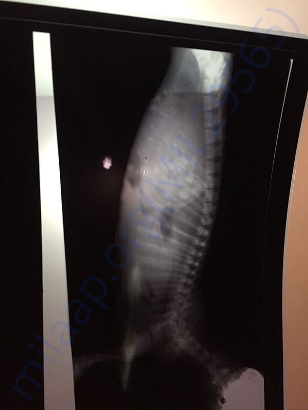 X Ray 2