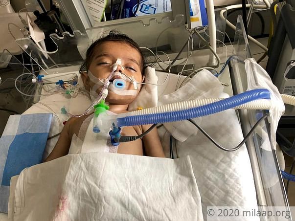 6 month old Baby Kirti needs an urgent heart surgery to breathe again