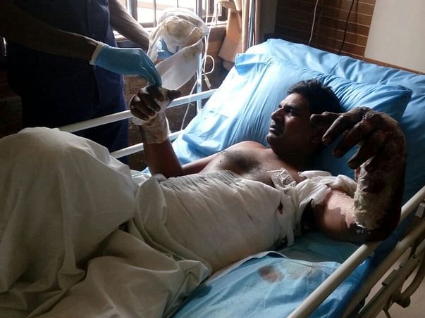 Help Thouhid For Treatment Of Severe Electric Shock