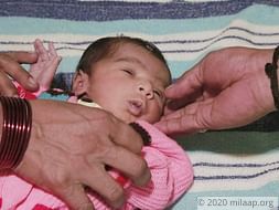 15 days old Baby of Durga needs an open heart surgery to survive.