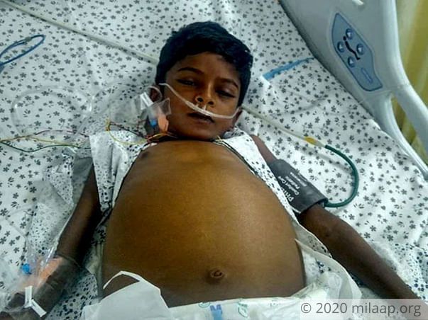 8-year-old Pawan Needs A Liver Transplant In Five Days To Live