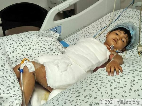 2-Year Old Is In The ICU After Falling Into A Bucket Of Boiling Water