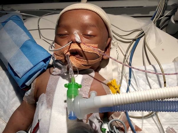 1.5 Month old Mohammed Ahil has to urgently undergo a cardiac surgery