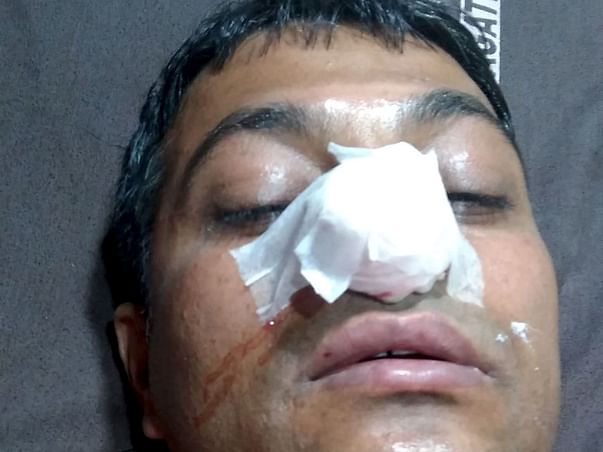 Help Me For My Hepatitis Treatment