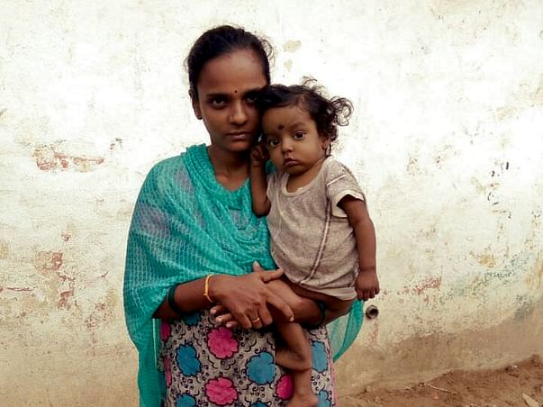 Please Help 1 Year Old Devansh Fight Biliary Atresia