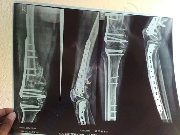 X ray