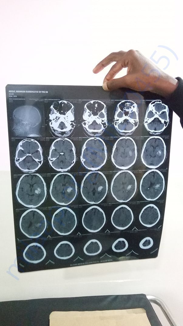 CT Scan Report