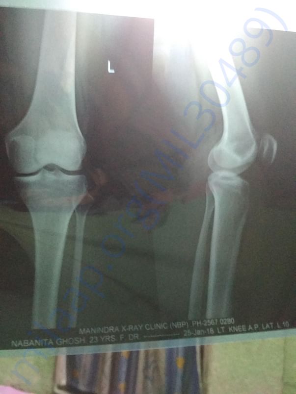 X-RAY